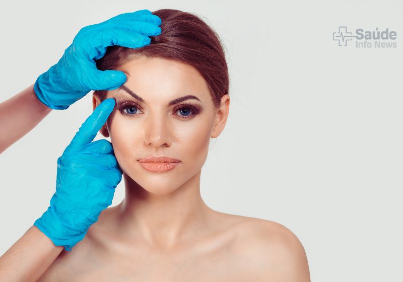 Blefaroplastia Palpebra Superior Antes E Depois (2)