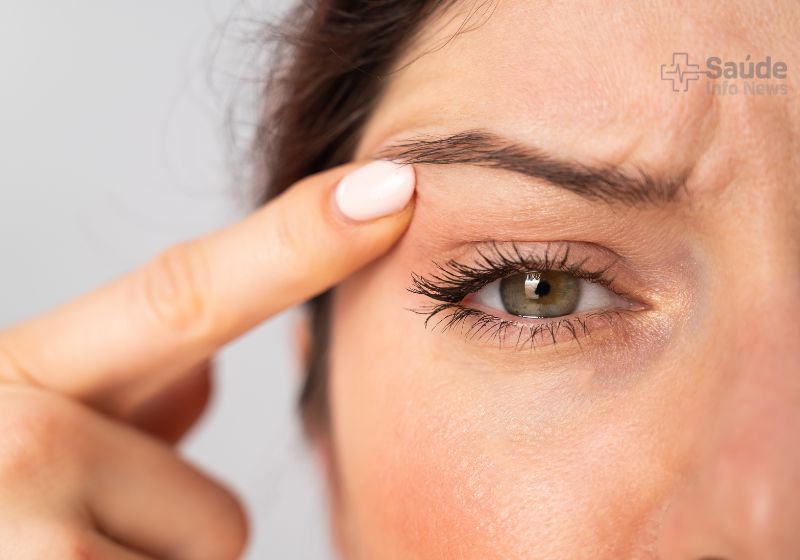 Blefaroplastia