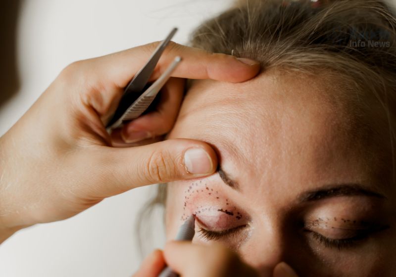 Preço Da Blefaroplastia (2)